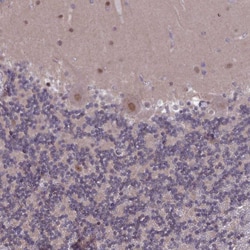 Invitrogen DIS3 Polyclonal Antibody 100 &mu;L; Unconjugated:Antibodies,