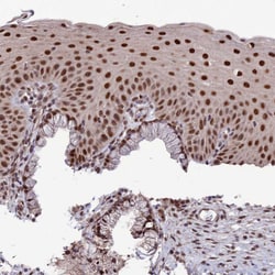 Invitrogen DIS3 Polyclonal Antibody 100 &mu;L; Unconjugated:Antibodies,