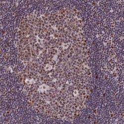 Invitrogen DIS3 Polyclonal Antibody 100 &mu;L; Unconjugated:Antibodies,