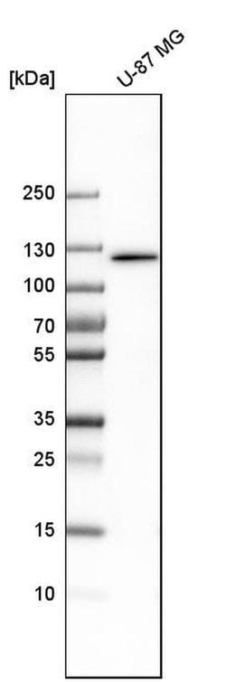 Invitrogen DIS3 Polyclonal Antibody 100 &mu;L; Unconjugated:Antibodies,