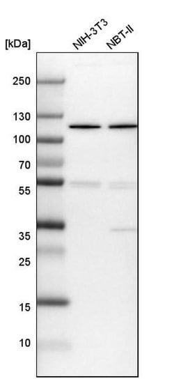 Invitrogen DIS3 Polyclonal Antibody 100 &mu;L; Unconjugated:Antibodies,