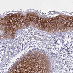 Invitrogen Spectrin beta-3 Polyclonal Antibody 100 &mu;L; Unconjugated:Antibodies,