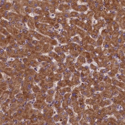 Invitrogen LARP4 Polyclonal Antibody 100 &mu;L; Unconjugated:Antibodies,