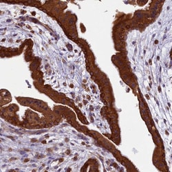 Invitrogen LARP4 Polyclonal Antibody 100 &mu;L; Unconjugated:Antibodies,