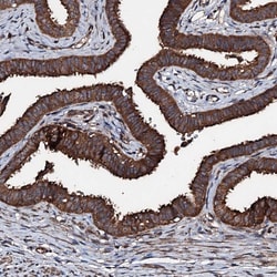 Invitrogen KIF18A Polyclonal Antibody 100 &mu;L; Unconjugated:Antibodies,