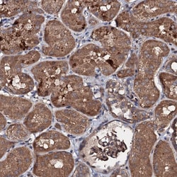 Invitrogen KIF18A Polyclonal Antibody 100 &mu;L; Unconjugated:Antibodies,