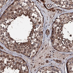 Invitrogen KIF18A Polyclonal Antibody 100 &mu;L; Unconjugated:Antibodies,