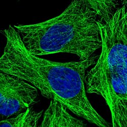 Invitrogen DEPDC4 Polyclonal Antibody 100 &mu;L; Unconjugated:Antibodies,