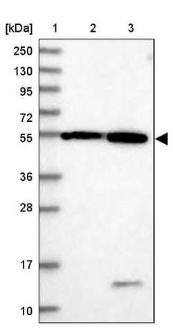 Invitrogen DEPDC4 Polyclonal Antibody 100 &mu;L | Buy Online | Invitrogen&trade; | Fisher Scientific