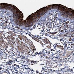 Invitrogen DEPDC4 Polyclonal Antibody 100 &mu;L; Unconjugated:Antibodies,