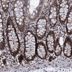 Invitrogen GALNT11 Polyclonal Antibody 100 &mu;L; Unconjugated:Antibodies,