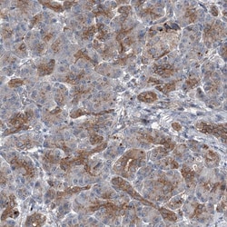 Invitrogen POLR1D Polyclonal Antibody 100 &mu;L; Unconjugated:Antibodies,