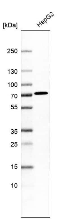 Invitrogen ACSS3 Polyclonal Antibody 100 &mu;L | Buy Online | Invitrogen&trade; | Fisher Scientific