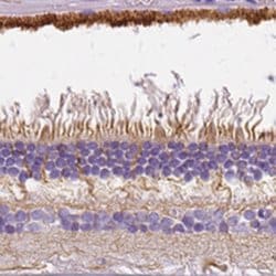 Invitrogen SLC24A1 Polyclonal Antibody 100 &mu;L; Unconjugated:Antibodies,