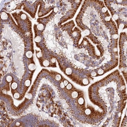 Invitrogen SI-CLP Polyclonal Antibody 100 &mu;L; Unconjugated:Antibodies,