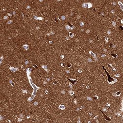 Invitrogen DMXL2 Polyclonal Antibody 100 &mu;L; Unconjugated:Antibodies,