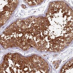 Invitrogen IP6 Kinase Polyclonal Antibody 100 &mu;L; Unconjugated:Antibodies,