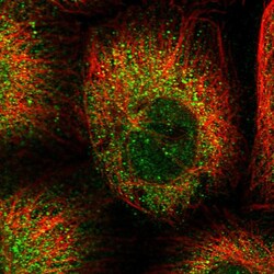 Invitrogen CCDC123 Polyclonal Antibody 100 &mu;L; Unconjugated:Antibodies,