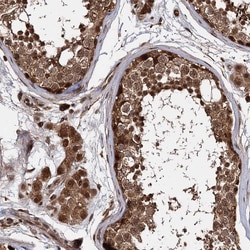 Invitrogen CEP192 Polyclonal Antibody 100 &mu;L; Unconjugated:Antibodies,