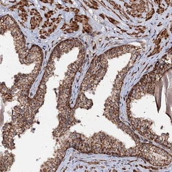 Invitrogen CEP76 Polyclonal Antibody 100 &mu;L; Unconjugated:Antibodies,