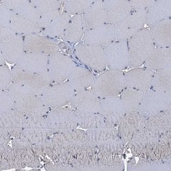 Invitrogen CCP110 Polyclonal Antibody 100 &mu;L | Buy Online | Invitrogen&trade; | Fisher Scientific