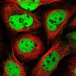 Invitrogen SMCHD1 Polyclonal Antibody 100 &mu;L; Unconjugated:Antibodies,