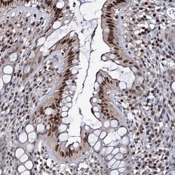 Invitrogen SMCHD1 Polyclonal Antibody 100 &mu;L; Unconjugated:Antibodies,
