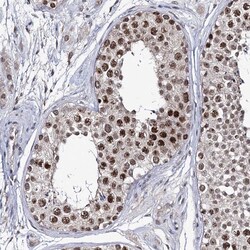 Invitrogen SMCHD1 Polyclonal Antibody 100 &mu;L; Unconjugated:Antibodies,
