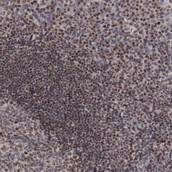 Invitrogen SMCHD1 Polyclonal Antibody 100 &mu;L; Unconjugated:Antibodies,
