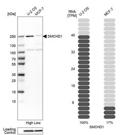 Invitrogen SMCHD1 Polyclonal Antibody 100 &mu;L; Unconjugated:Antibodies,