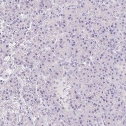 Invitrogen MIOX Polyclonal Antibody 100 &mu;L | Buy Online | Invitrogen&trade; | Fisher Scientific