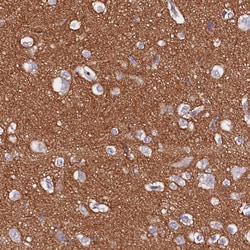Invitrogen FAM155A Polyclonal Antibody 100 &mu;L; Unconjugated:Antibodies,