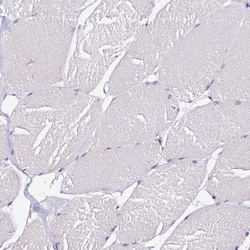 Invitrogen FAM155A Polyclonal Antibody 100 &mu;L; Unconjugated:Antibodies,