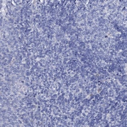 Invitrogen AMER2 Polyclonal Antibody 100 &mu;L; Unconjugated:Antibodies,