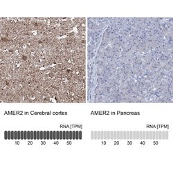 Invitrogen AMER2 Polyclonal Antibody 100 &mu;L; Unconjugated:Antibodies,