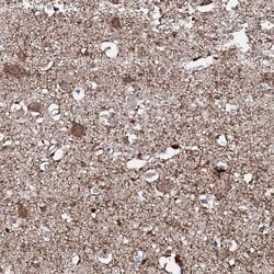 Invitrogen AMER2 Polyclonal Antibody 100 &mu;L; Unconjugated:Antibodies,