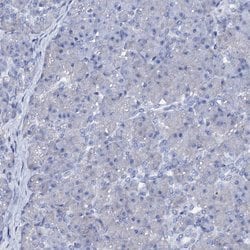 Invitrogen AMER2 Polyclonal Antibody 100 &mu;L; Unconjugated:Antibodies,