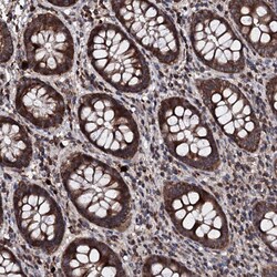 Invitrogen C11orf79 Polyclonal Antibody 100 &mu;L; Unconjugated:Antibodies,