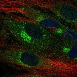 Invitrogen CLEC14A Polyclonal Antibody 100 &mu;L; Unconjugated:Antibodies,