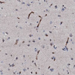 Invitrogen CLEC14A Polyclonal Antibody 100 &mu;L; Unconjugated:Antibodies,
