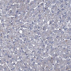 Invitrogen CLEC14A Polyclonal Antibody 100 &mu;L; Unconjugated:Antibodies,
