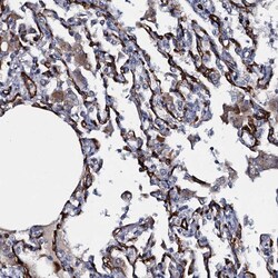 Invitrogen CLEC14A Polyclonal Antibody 100 &mu;L; Unconjugated:Antibodies,