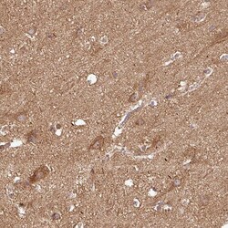 Invitrogen PLEKHM1 Polyclonal Antibody 100 &mu;L; Unconjugated:Antibodies,