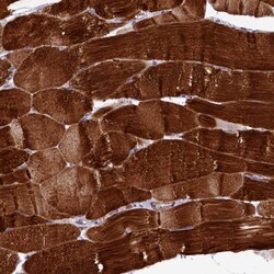 Invitrogen RAPSN Polyclonal Antibody 100 &mu;L; Unconjugated:Anticorps,