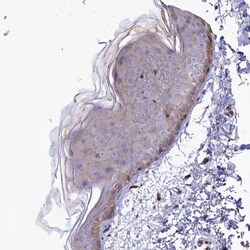 Invitrogen RAPSN Polyclonal Antibody 100 &mu;L; Unconjugated:Anticorps,