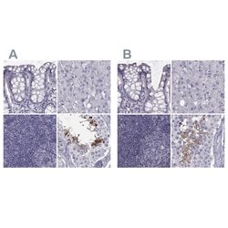 Invitrogen FAM71B Polyclonal Antibody 100 &mu;L; Unconjugated:Antibodies,
