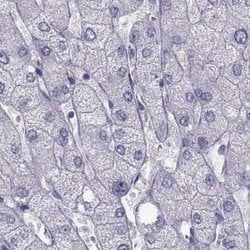 Invitrogen FAM71B Polyclonal Antibody 100 &mu;L; Unconjugated:Antibodies,