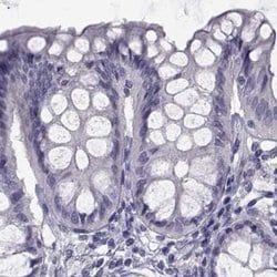 Invitrogen FAM71B Polyclonal Antibody 100 &mu;L; Unconjugated:Antibodies,