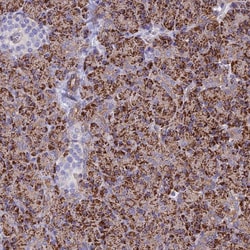 Invitrogen ALDH1L2 Polyclonal Antibody 100 &mu;L; Unconjugated:Antibodies,