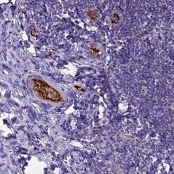Invitrogen TCP11L2 Polyclonal Antibody 100 &mu;L; Unconjugated:Antibodies,